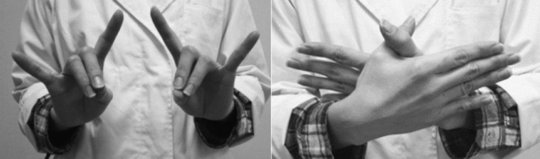 言葉が出てこない 急に箸が使えなくなる 認知症 の初期症状 現役医師が解説 富裕層向け資産防衛メディア 幻冬舎ゴールドオンライン