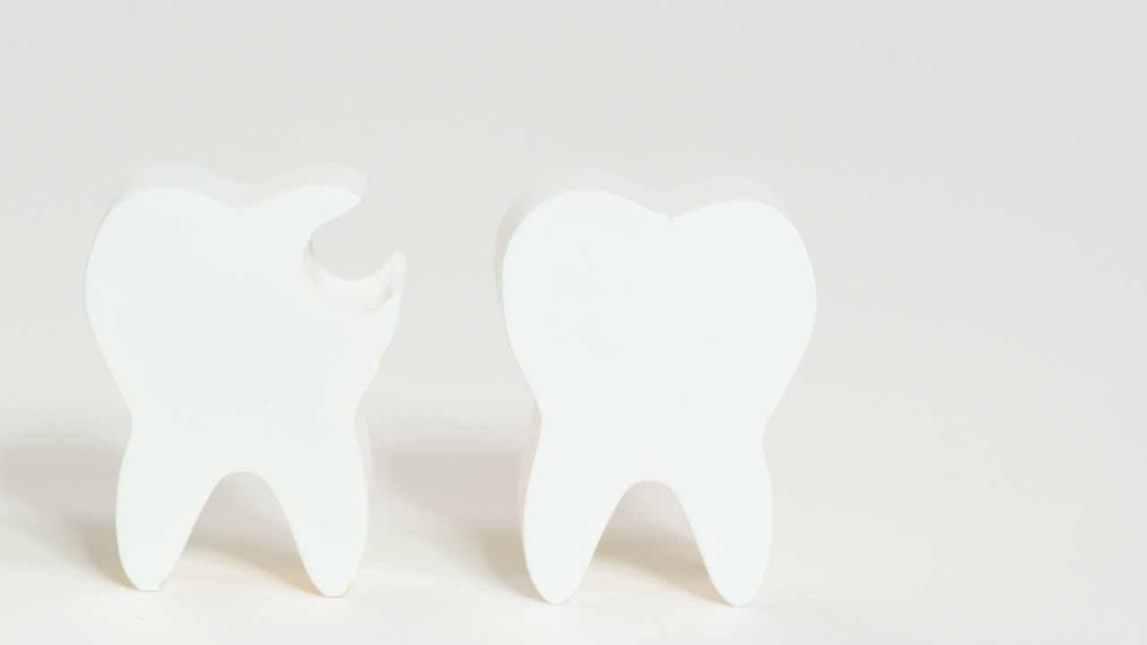 小さな虫歯に秘められた「将来の健康増進」のヒントとは？