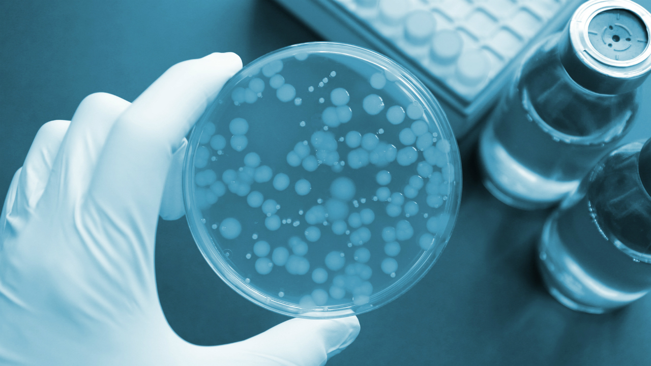 微生物で「抗体医薬」安く　関連銘柄の探し方