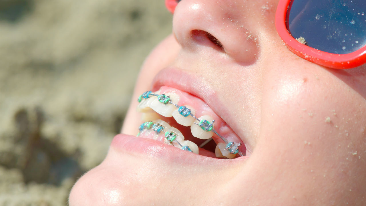 「子どもの頃の矯正歯科治療」のメリットが大きい理由