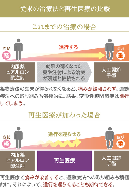 ひざに水がたまったらどうすればいい 原因と治療法を解説 富裕層向け資産防衛メディア 幻冬舎ゴールドオンライン