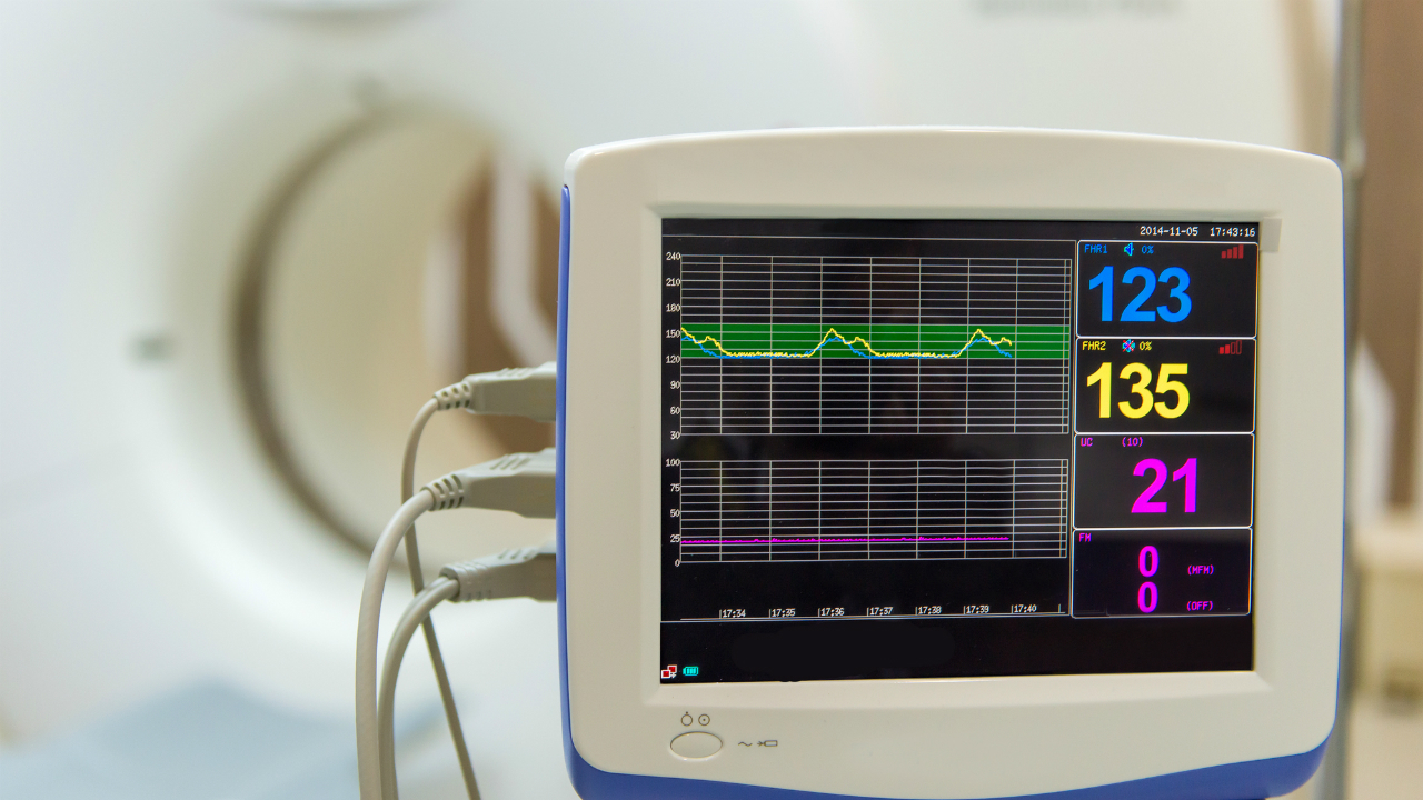 高額な最新医療機器…導入せざるを得ない病院の事情 