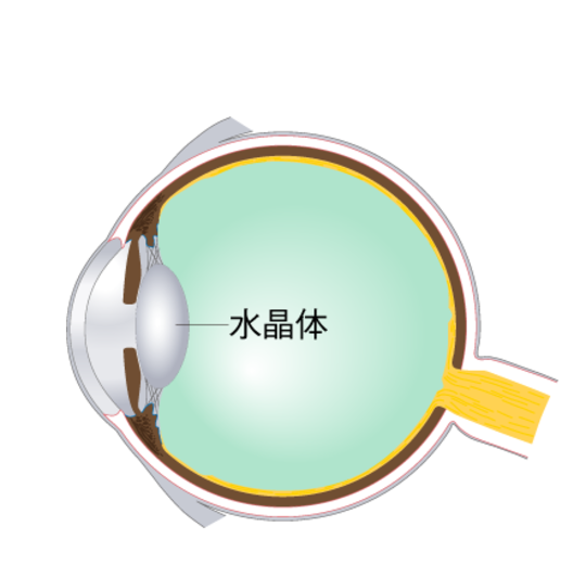 水晶体の袋は、術後収縮するため